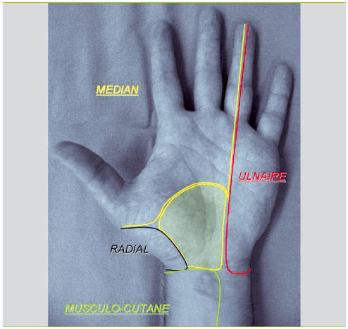 Anatomie de la main et du poignet - Articulations, os du carpe, tendons et  nerfs, Pathologie de la main