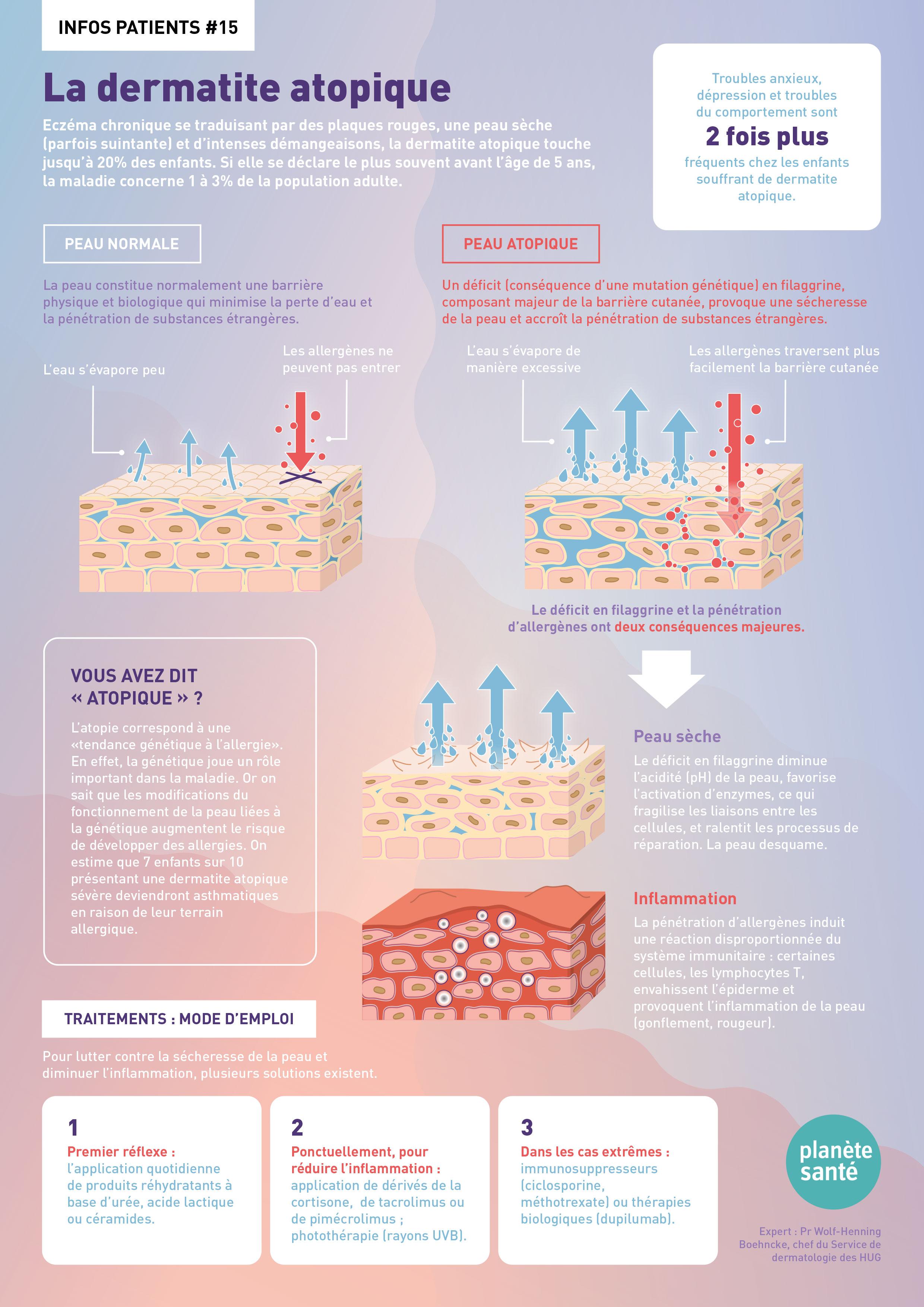 Dermatite atopique | Revue Medicale Suisse