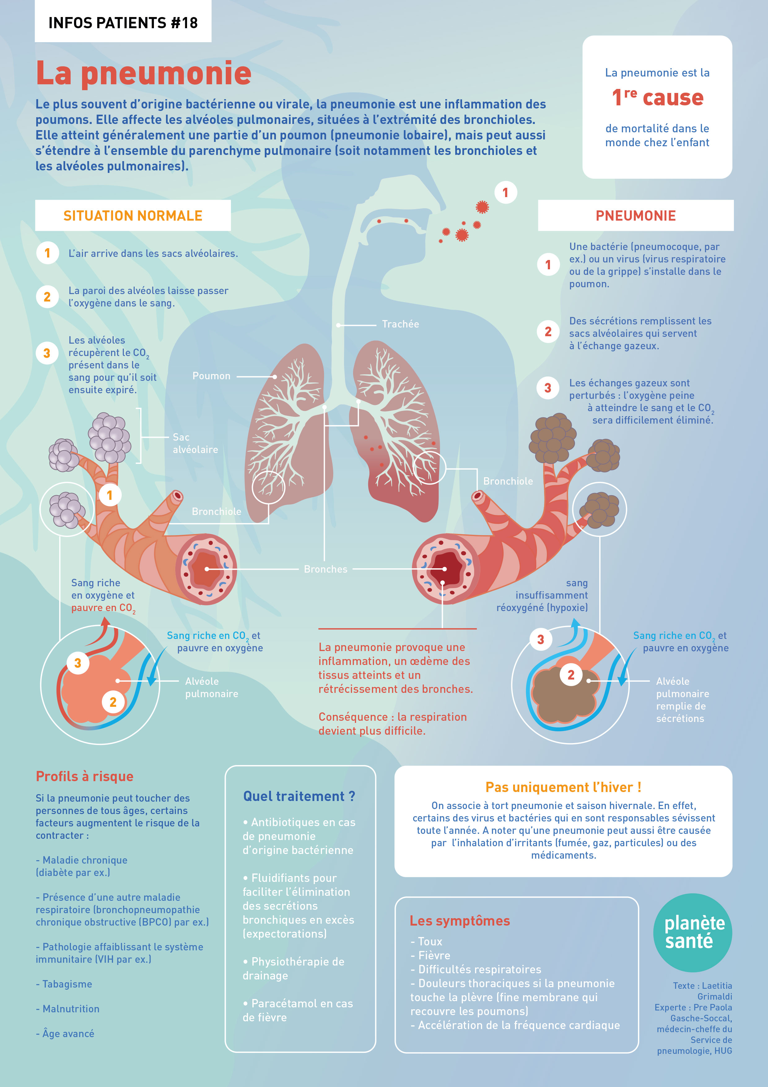 diagramme de pneumonie virale