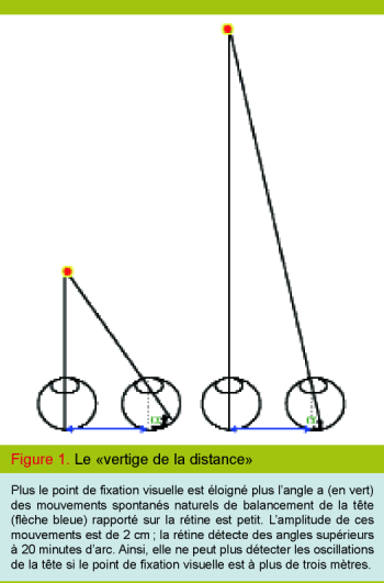 Vrai Ou Faux Vertige Une Vraie Ou Fausse Question Revue Medicale Suisse